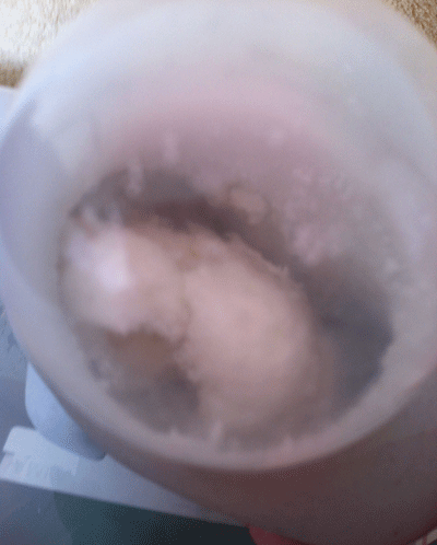 Adipose left in sun